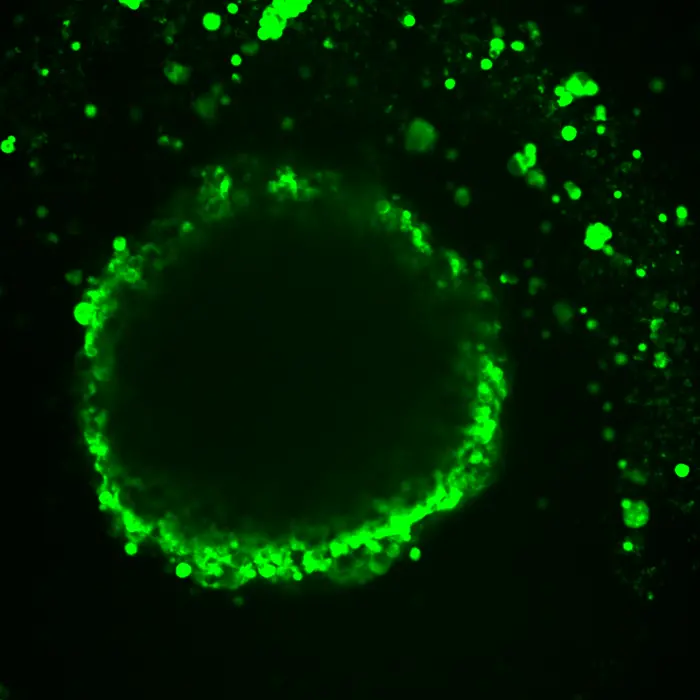 Fluorescent Dye Uptake in Ovarian Cancer Model