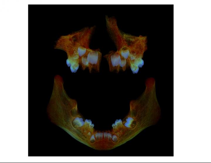 Anglo Saxon Child's Jaw