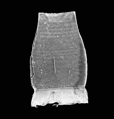 Specimen of the Chitinozoan Species <i>Armoricochitina</i>