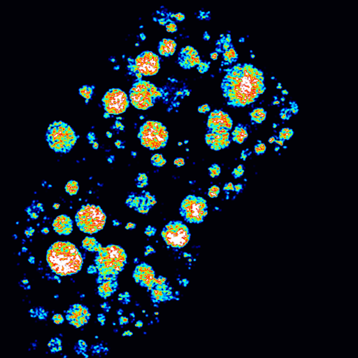 Bioengineers visualize fat storage in fruit flies after changes in diet