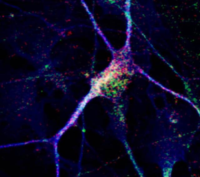 New Neurons Reveal Clues about An Individual's Autism
