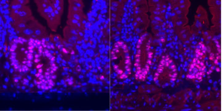 Enhance Regeneration and Calorie Restriction