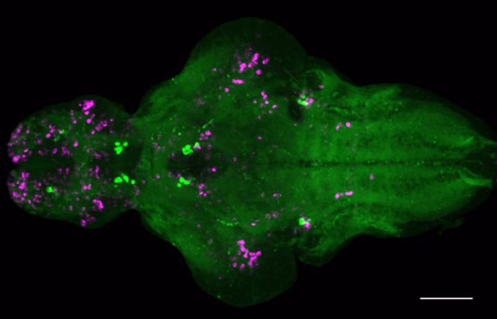 Zebrafish Brain Following Overexpression of Nmu, a Gene Shown to Help Regulate Sleep