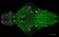 Zebrafish Brain Following Overexpression of Nmu, a Gene Shown to Help Regulate Sleep