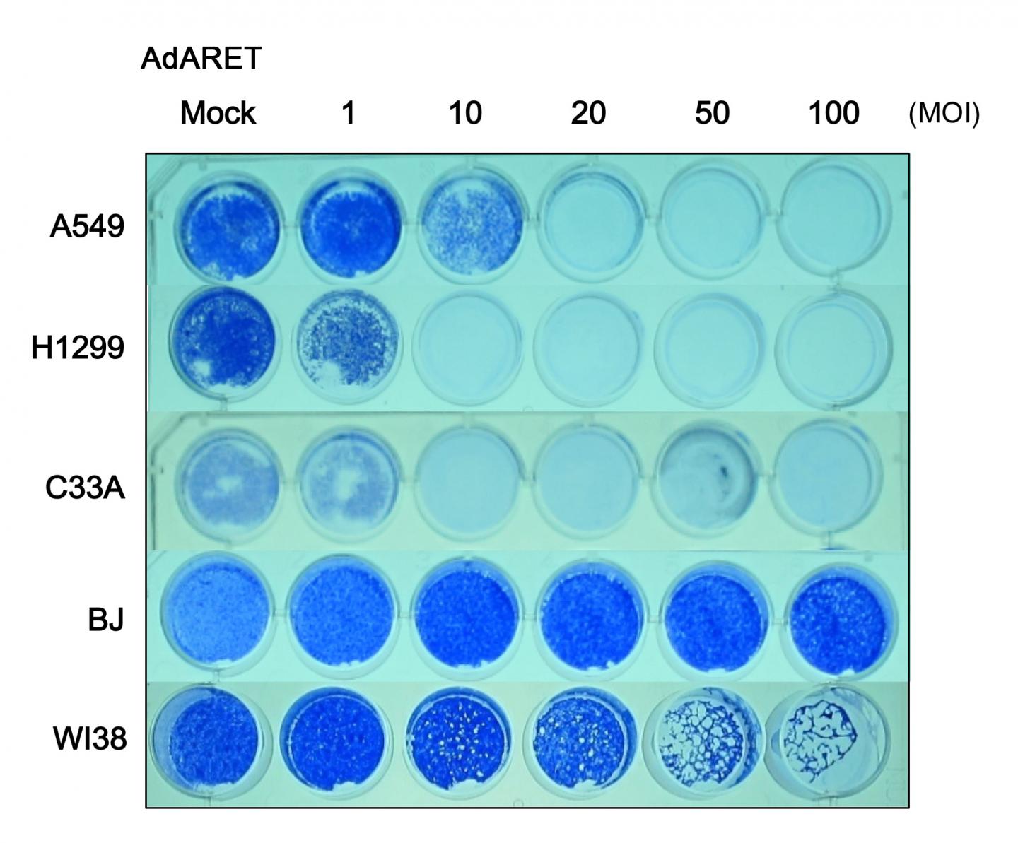 The AdARET Killed Cancer Cells