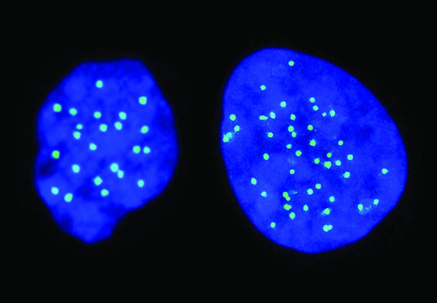 Haploid and Diploid Cells