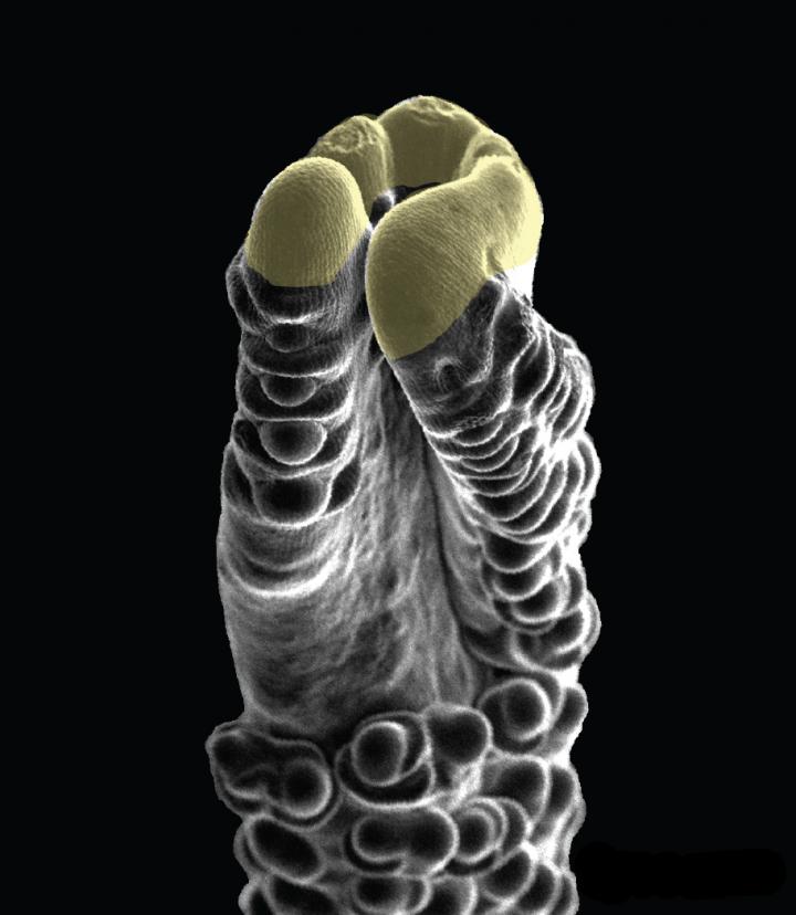 Pathway to Higher Yield