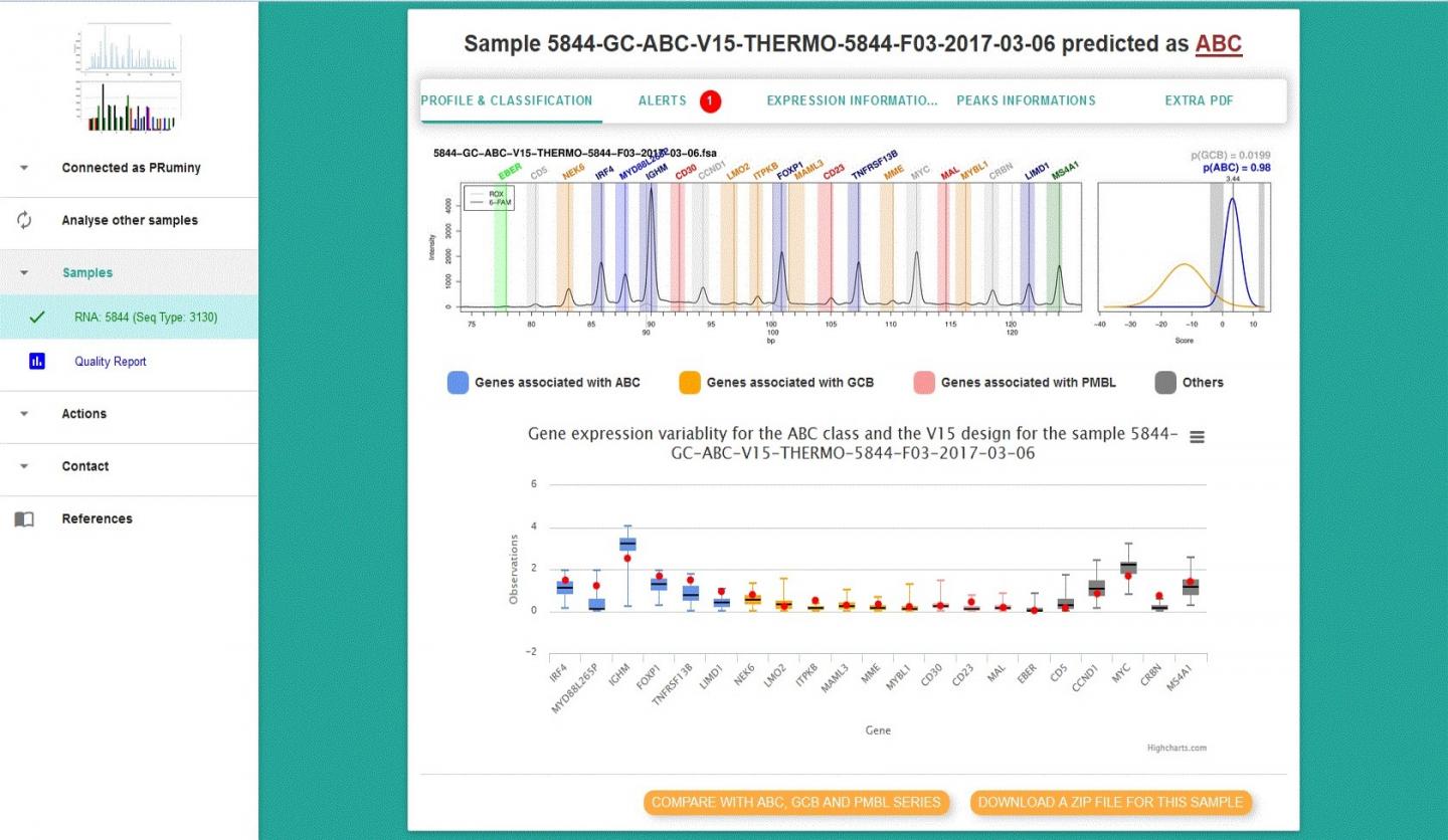 New Assay May Boost Targeted Treatment of Non-Hodgkin Lymphoma