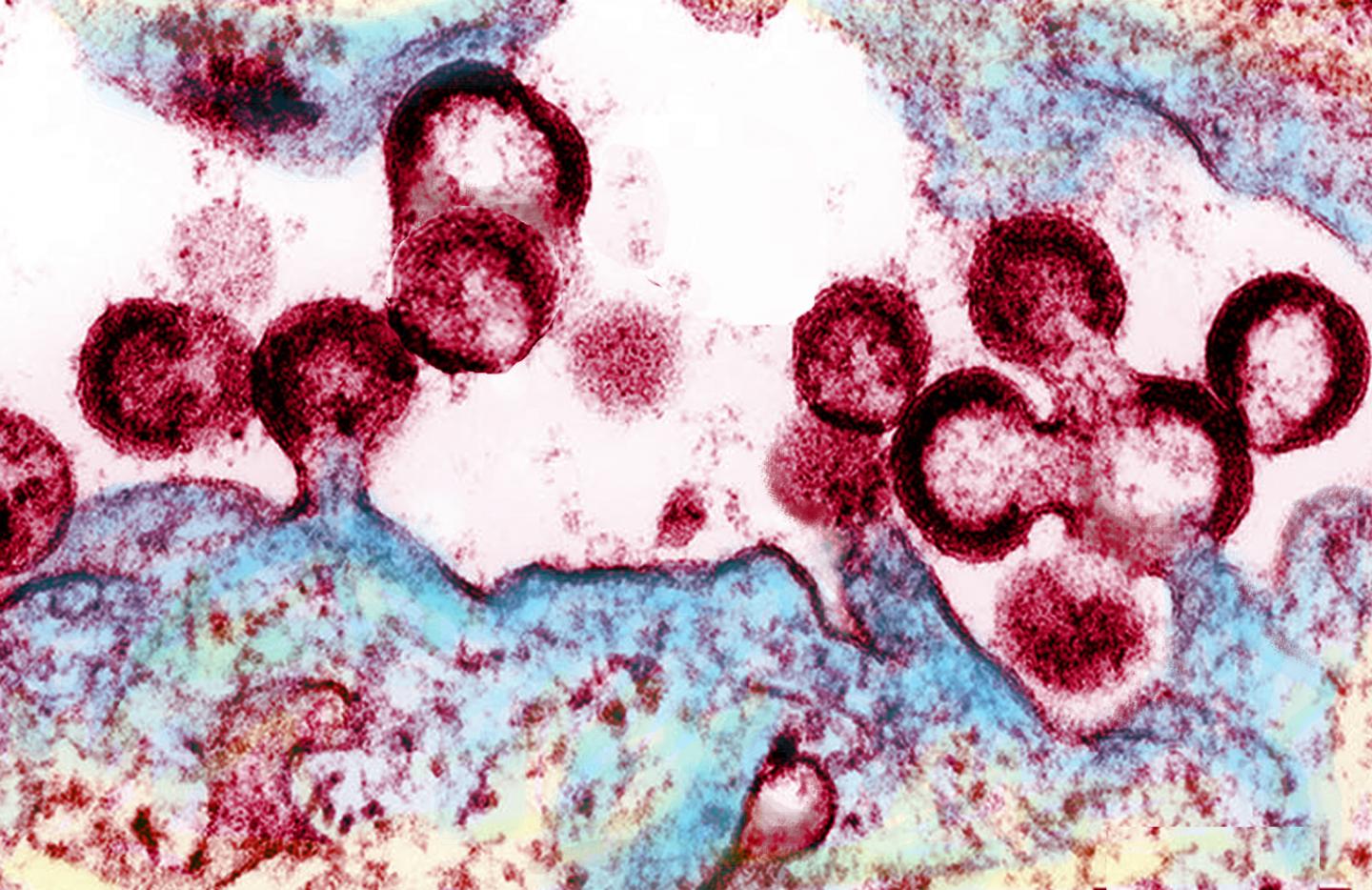 HIV Virions Budding from An Infected Cell