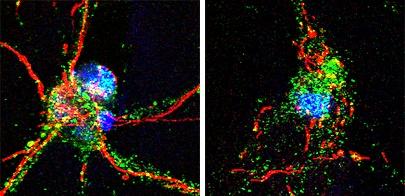 Mouse Neurons with Intact and Damaged Axons