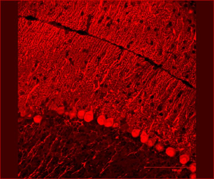 microRNA Therapy Protects Against Neurodegenerative Disorder (5 of 6)