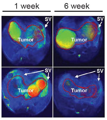 How Do Cancer Cells Deal with Stress? (1 of 1)