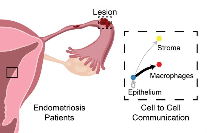 MSU researchers make progress toward non-hormonal treatment for endometriosis