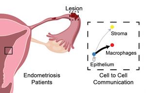 MSU researchers make progress toward non-hormonal treatment for endometriosis