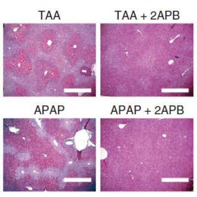 Gap Inhibitor Reduces Liver Damage