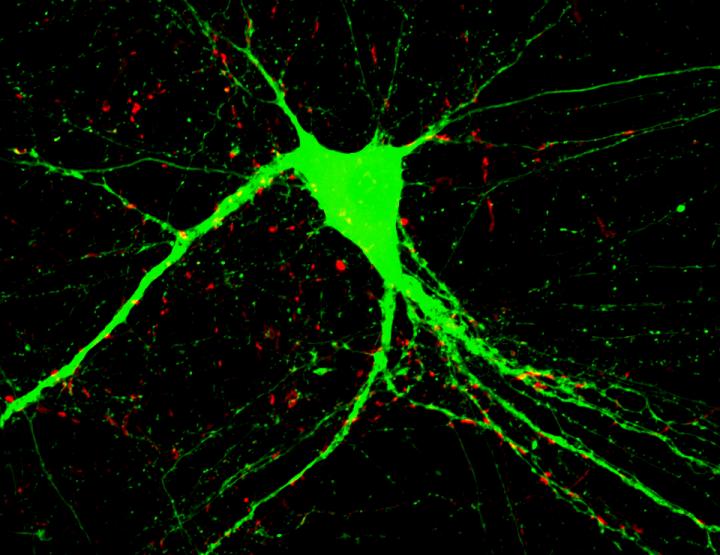 Cultured Neuron with An Added BDNF Protein