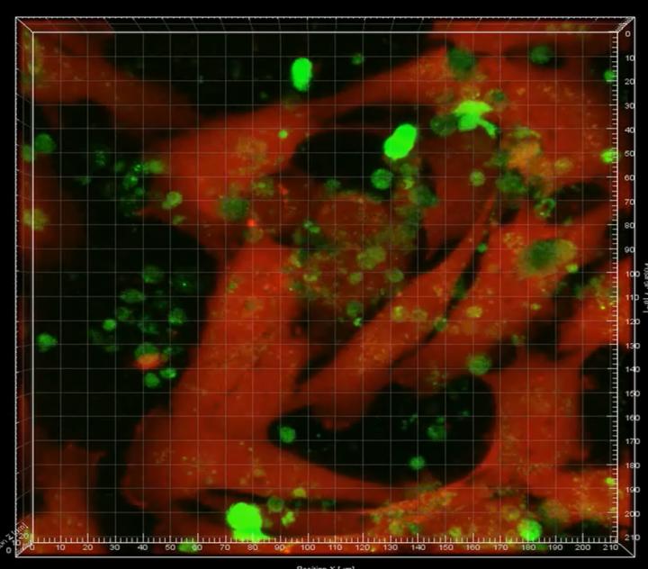 Leukemia Cells Hide Within Bone Marrow