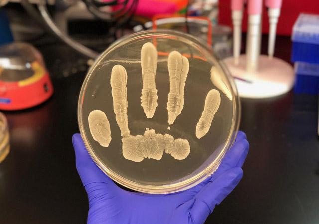 <em>S. epidermidis</em>