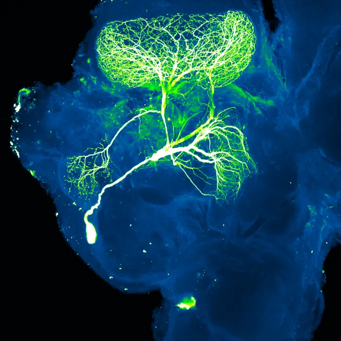 Neuron projection.