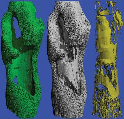 Micro-Ct Imaging of Osteomyelitis Model