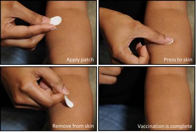 Application of Microneedle Patch