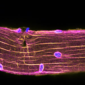 Muscle lesions attract myonuclei to repair the damage