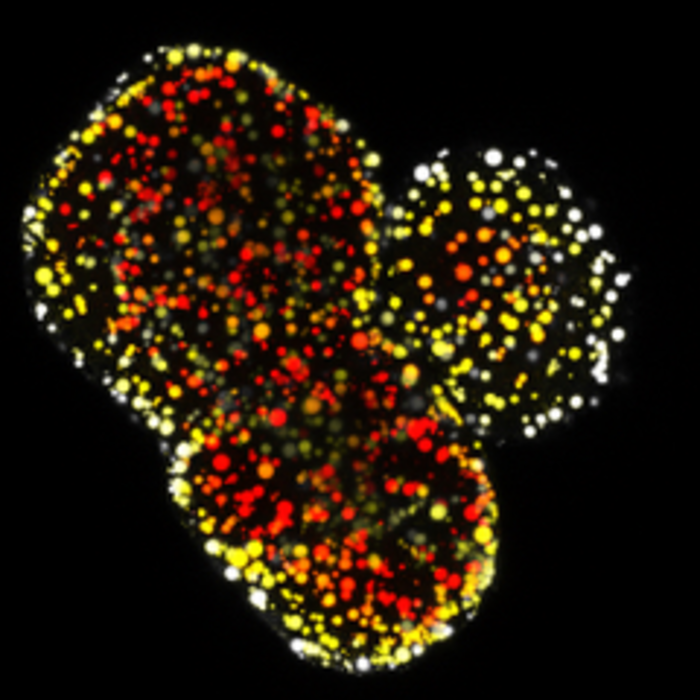 Organoid modeling a genetic lipid disorder.