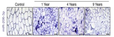 Image Scientists Uncover a Novel Approach to Treating Duchenne Muscular Dystrophy