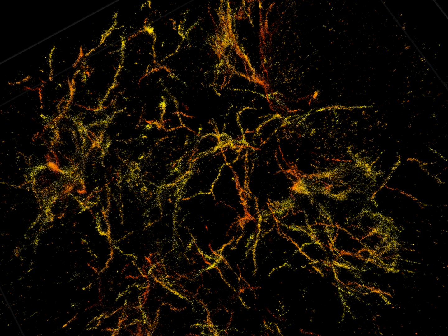 3D Single Molecule Super-Resolution Image of Amyloid Plaques