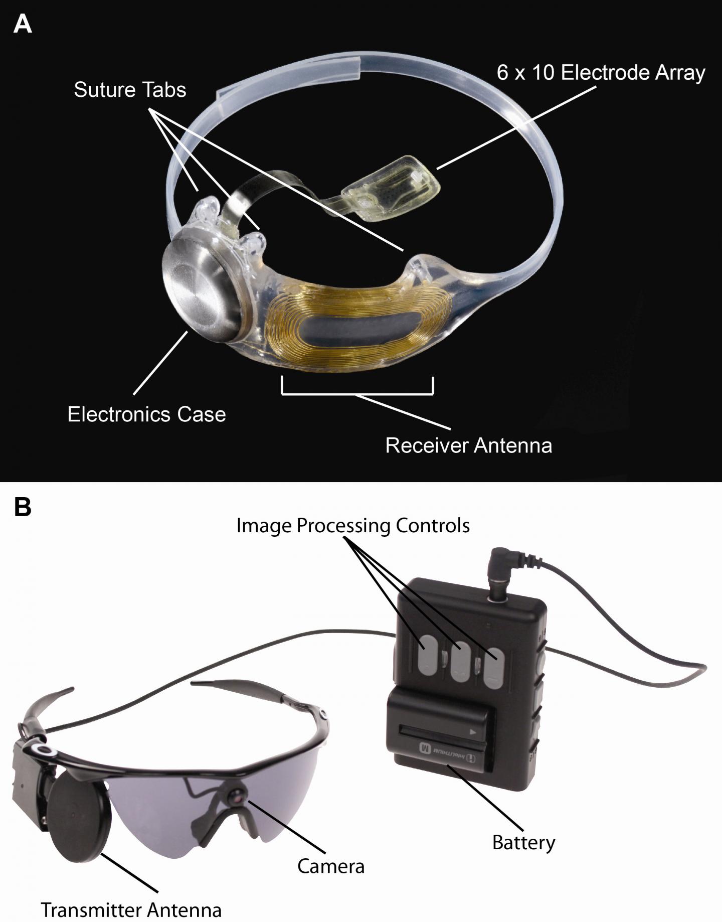 The Argus II System