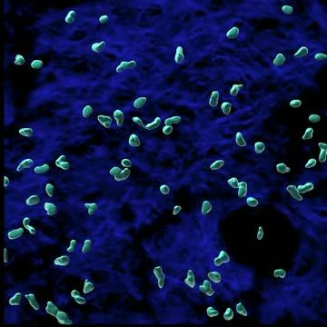 Swarming Neutrophils in tissue