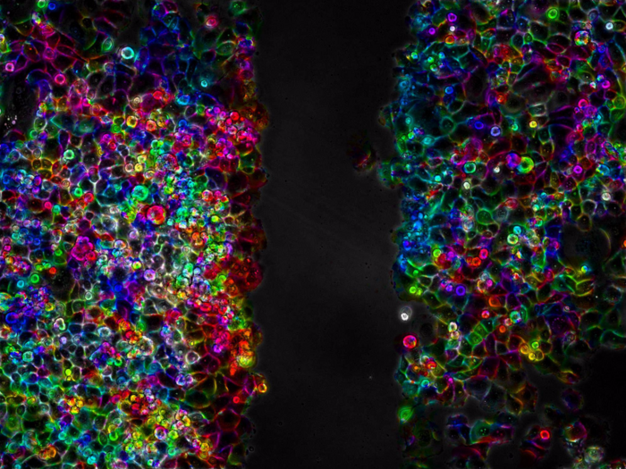Pancreatic cancer cells inhibi image eurekalert science news releases