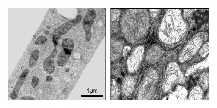 Mitochondria of Liver Cells