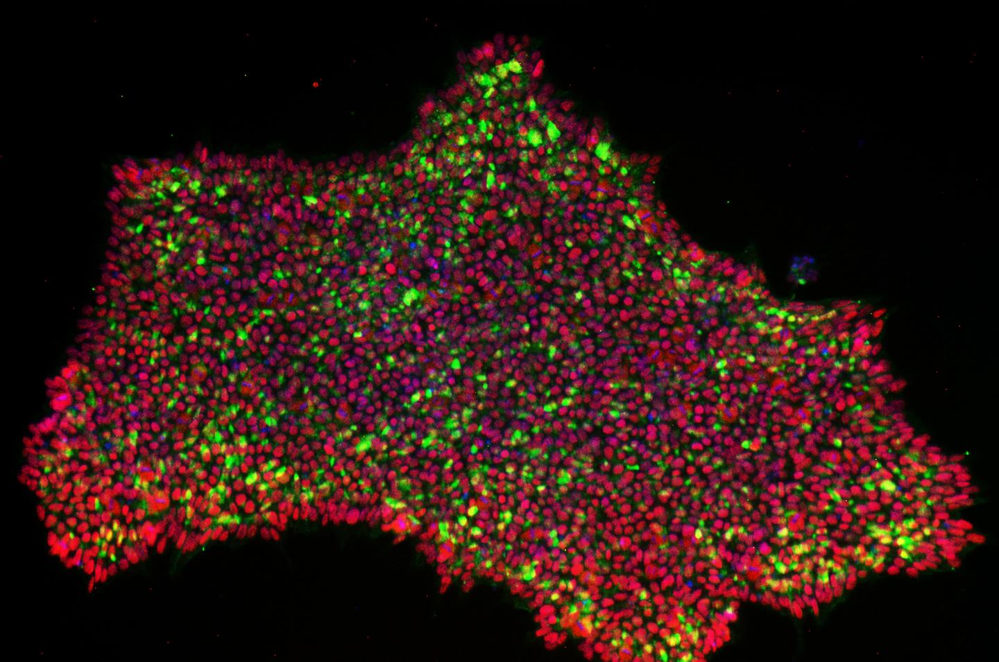 Converting Human Skin Cells Into Pluripotent Stem Cells