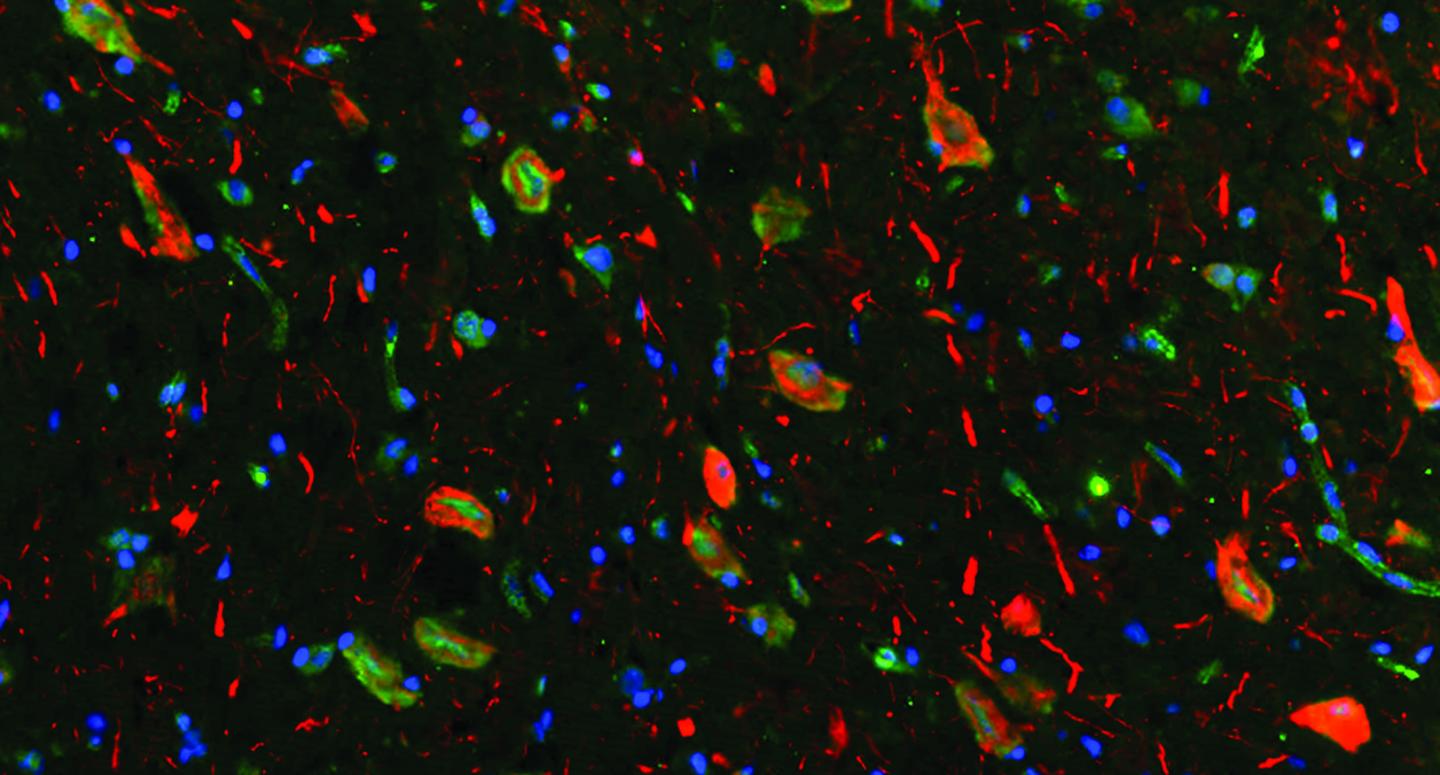 Correcting Cortical Defects and Seizures in Treatment-Resistant Epilepsy in Mice (2 of 2)