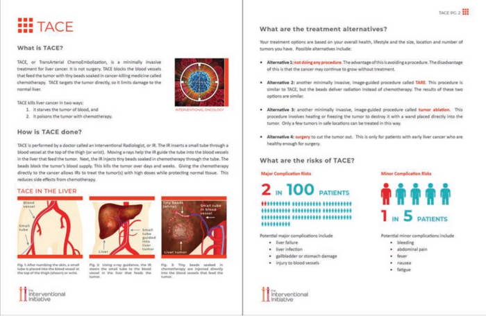Example patient decision aid for transarterial radioembolization (TARE)