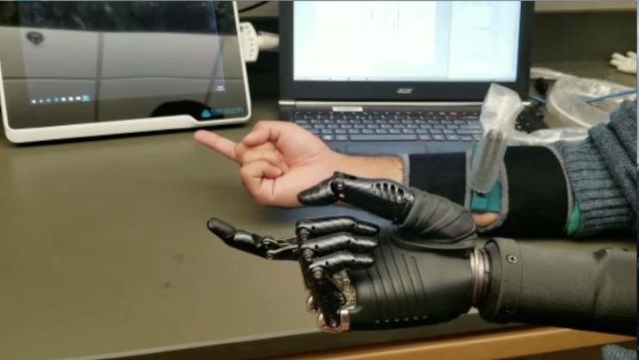 New Tech Helps Prosthetic Hand Perform Better