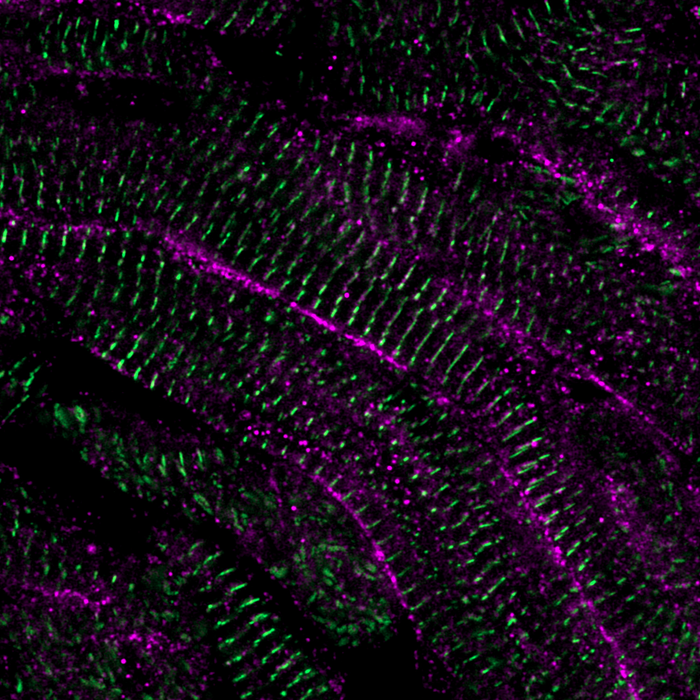 Zebrafish heart 60 days after injury