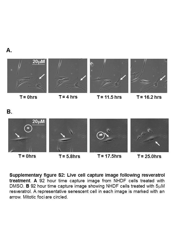 Live Cell Capture Image Following Resveratrol Treatment