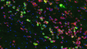 Neurons in amygdala drive hedonic eating