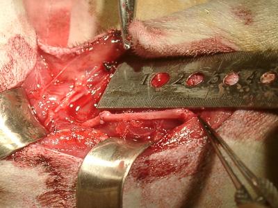 Intraoperative Photograph