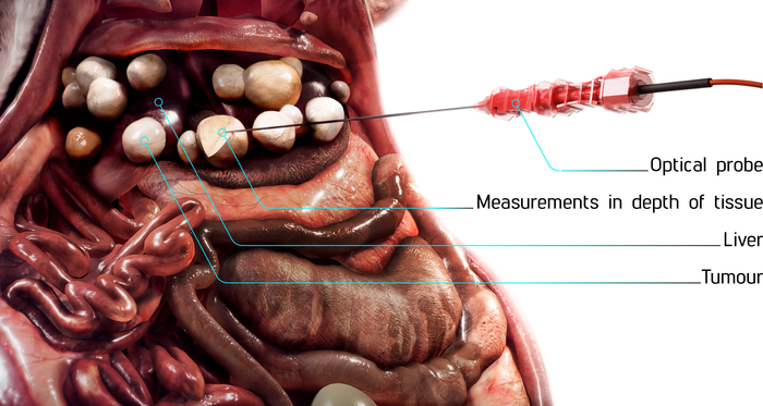 : Optical Biopsy System