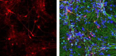 Dopaminergic Neurons