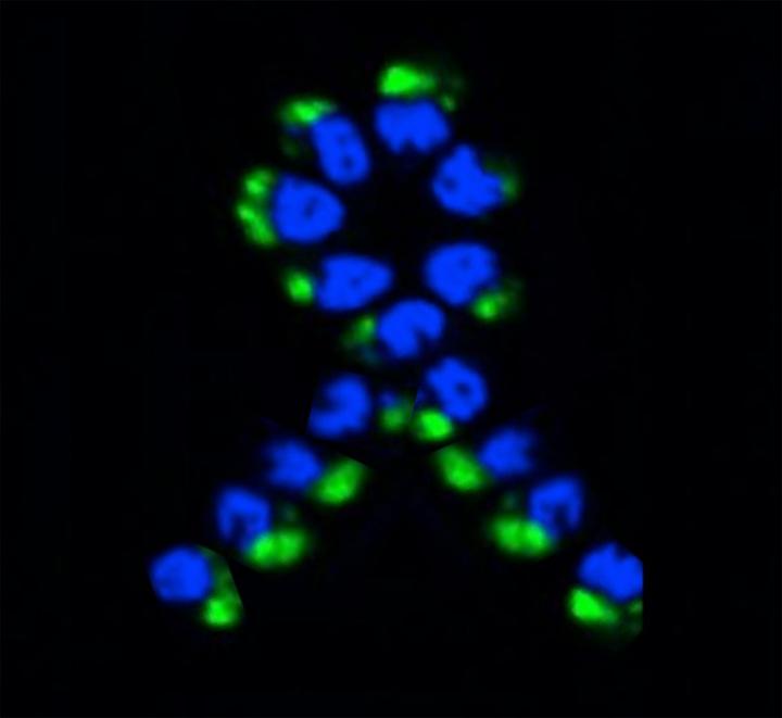 An Ordered String or Ribbon of <em>Toxoplasma</em> Parasites