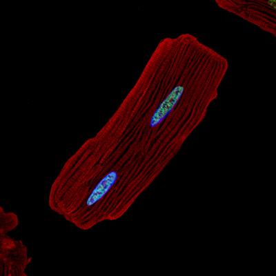 Rat cardiac myocyte