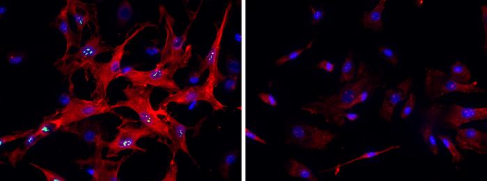 Hepatic stellate cells