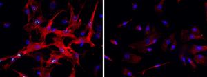 Hepatic stellate cells