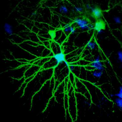 Song Bird Neurons, Highly Magnified