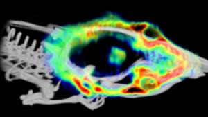 PET/CT 3D fusion image