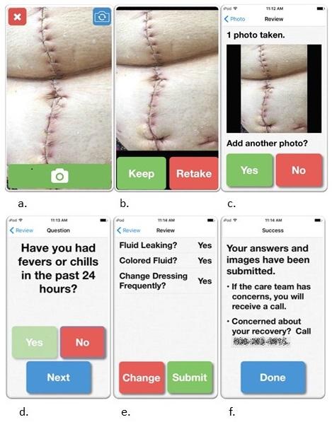 Post-op Wound Care • CAN-Sim